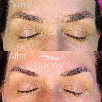 Before (without Microblading) and after (with microblading)