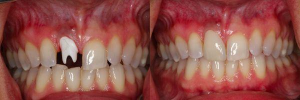 Cosmetic and Implant Dentistry of Connecticut | Branford, CT