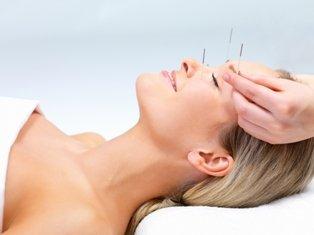 Acupuncture