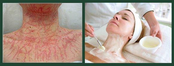 Now offering DMK Plasma Effect Enzyme Treatments!