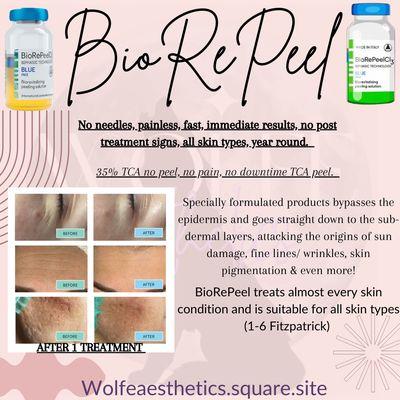 BioRePeel Advanced Exfoliation