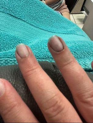 My nail beds were swollen and sensitive to the touch for days after. You can see all the blue liquid they put on from cutting me.