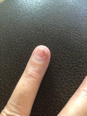 Fingernail