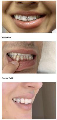 Tooth gap and grill styles