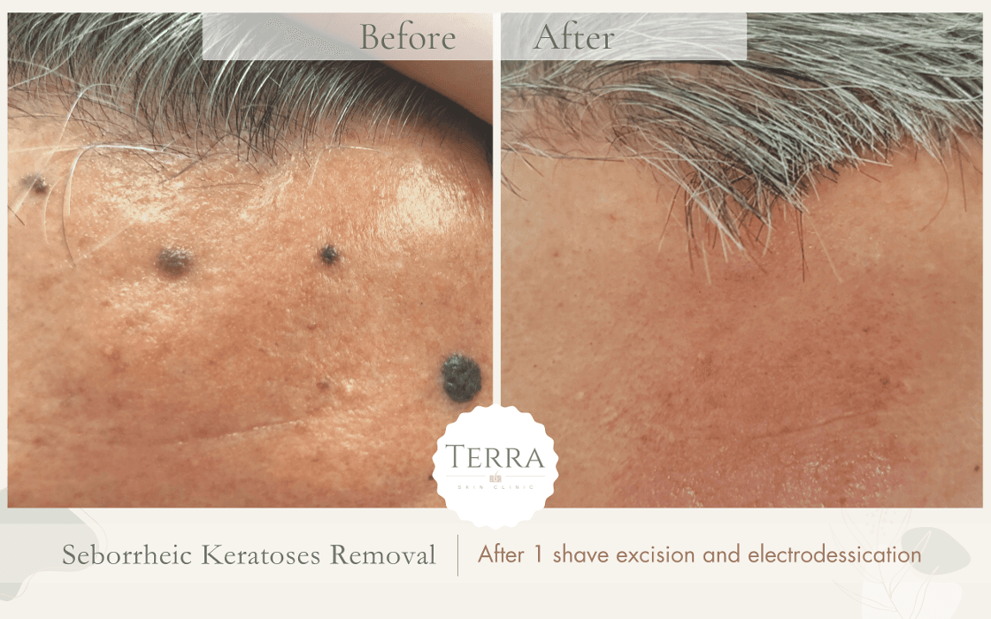 Terra Skin Clinic